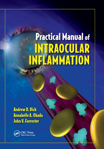 Паперова книга «Practical Manual of Intraocular Inflammation», авторів Ендрю Дік, Аннабель Окада, Джон Форрестер - фото №1