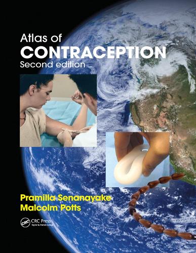Паперова книга «Atlas of Contraception», авторів Малкольм Поттс, Прамілла Сенанаяке - фото №1