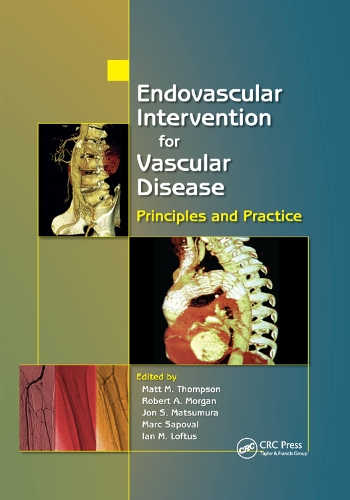 Паперова книга «Endovascular Intervention for Vascular Disease: Principles and Practice» - фото №1
