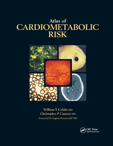 Паперова книга «Atlas of Cardiometabolic Risk», авторів Крістофер П. Кеннон, Вільям Т. Чефалу - фото №1