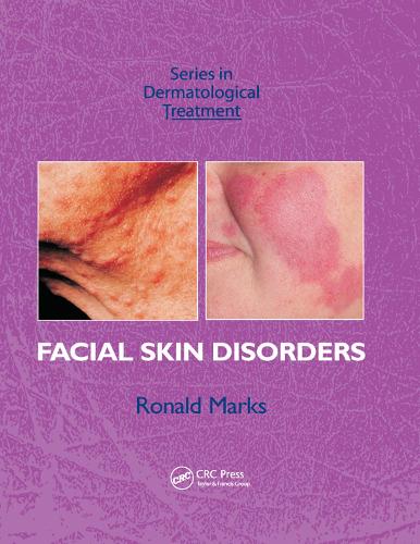Бумажная книга «Facial Skin Disorders», автор Рональд Маркс - фото №1