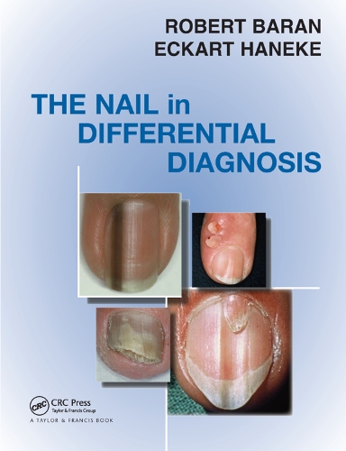 Бумажная книга «Nail in Differential Diagnosis», авторов Экарт Ханеке, Роберт Баран - фото №1