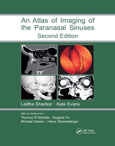 Бумажная книга «Atlas of Imaging of the Paranasal Sinuses, Second Edition» - фото №1