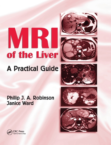 Бумажная книга «MRI of the Liver: A Practical Guide», авторов Дженис Уорд, Филип Дж. А. Робинсон - фото №1