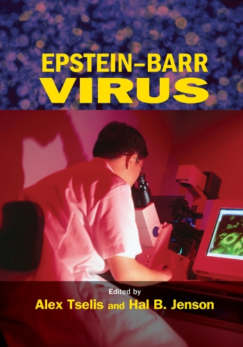 Паперова книга «Epstein-Barr Virus» - фото №1