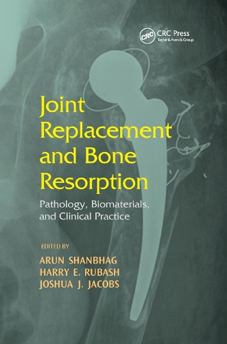 Бумажная книга «Joint Replacement and Bone Resorption: Pathology, Biomaterials and Clinical Practice» - фото №1