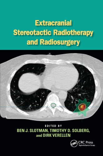 Паперова книга «Extracranial Stereotactic Radiotherapy and Radiosurgery» - фото №1