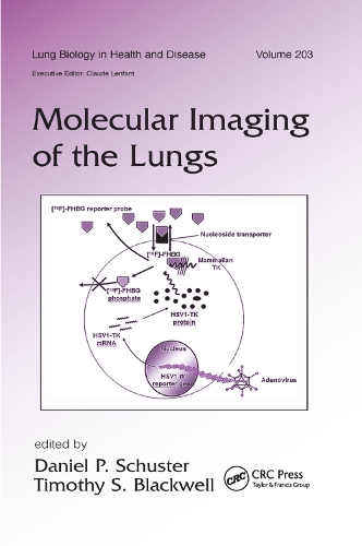 Бумажная книга «Molecular Imaging of the Lungs» - фото №1