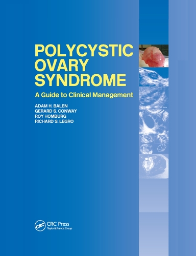Паперова книга «Polycystic Ovary Syndrome: A Guide to Clinical Management» - фото №1