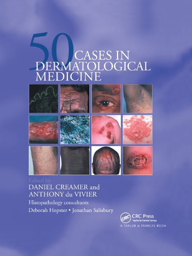 Бумажная книга «Fifty Dermatological Cases», авторов Энтони дю Вивье, Дэниел Кример - фото №1