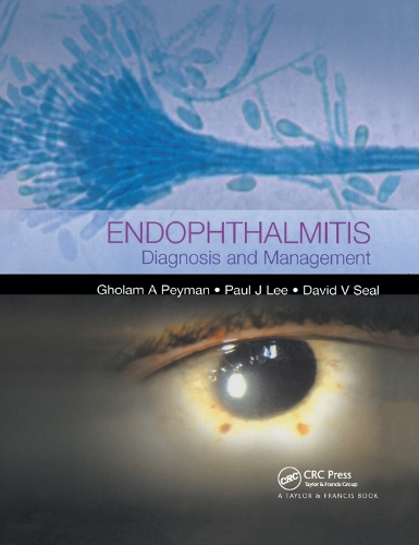 Бумажная книга «Endophthalmitis: Diagnosis and Treatment» - фото №1