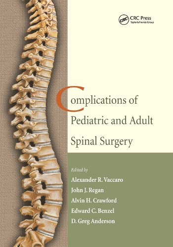 Паперова книга «Complications of Pediatric and Adult Spinal Surgery» - фото №1