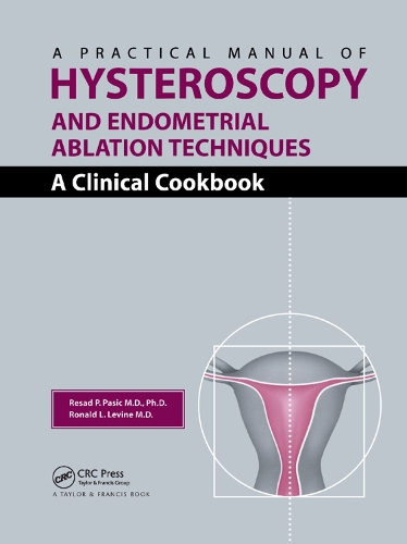Бумажная книга «A Practical Manual of Hysteroscopy and Endometrial Ablation Techniques: A Clinical Cookbook», авторов Резад П. Пашич, Рональд Леон Левин - фото №1