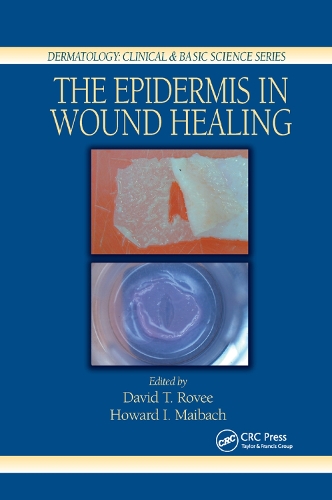 Паперова книга «The Epidermis in Wound Healing» - фото №1