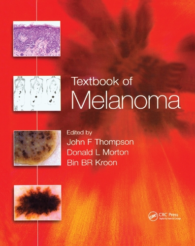 Паперова книга «Textbook of Melanoma: Pathology, Diagnosis and Management» - фото №1
