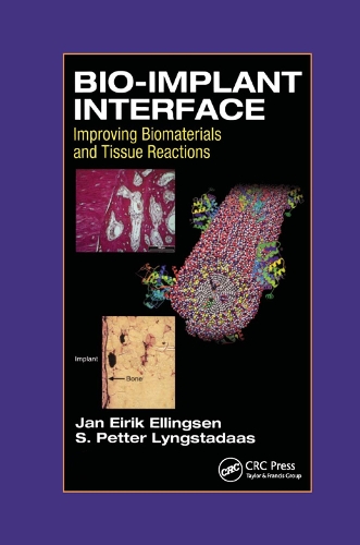 Бумажная книга «Bio-Implant Interface: Improving Biomaterials and Tissue Reactions», авторов Дж. Э. Эллингсен, С.П. Лингстадас - фото №1