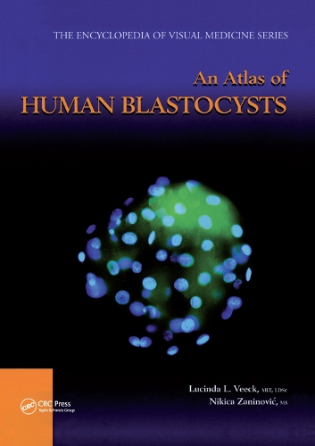Бумажная книга «An Atlas of Human Blastocysts», авторов Люсинда Л. Вик, Никита Занинович - фото №1