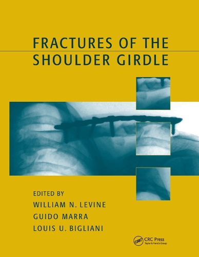 Бумажная книга «Fractures of the Shoulder Girdle», авторов Гвидо Марра, Уильям Н. Левин - фото №1