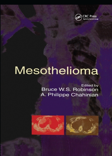 Паперова книга «Mesothelioma» - фото №1