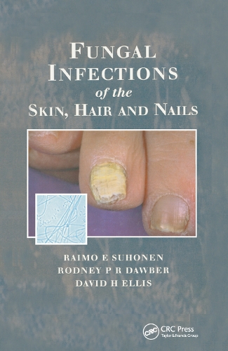 Бумажная книга «Fungal Infections of the Skin and Nails», авторов Дэвид Х. Эллис, Раймо Э. Сухонен, Родни П.Р. Доубер - фото №1