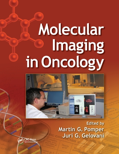 Паперова книга «Molecular Imaging in Oncology» - фото №1