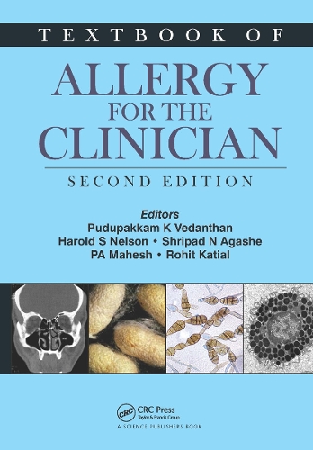 Паперова книга «Textbook of Allergy for the Clinician» - фото №1