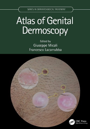 Бумажная книга «Atlas of Genital Dermoscopy» - фото №1