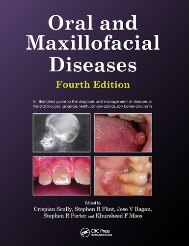 Бумажная книга «Oral and Maxillofacial Diseases», авторов Криспиан Скалли, Стивен Флинт - фото №1
