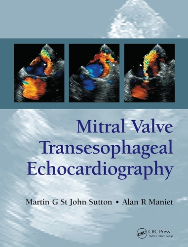 Бумажная книга «Mitral Valve Transesophageal Echocardiography», авторов Алан Р. Маниет, Мартин Г. Сент-Джон Саттон - фото №1