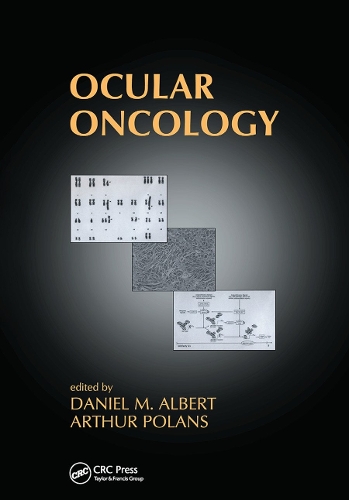 Паперова книга «Ocular Oncology» - фото №1
