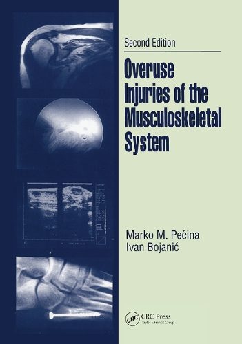 Бумажная книга «Overuse Injuries of the Musculoskeletal System», авторов Иван Боянич, Марко М. Печина - фото №1
