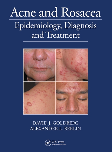 Бумажная книга «Acne and Rosacea: Epidemiology, Diagnosis and Treatment», авторов Александр Берлин, Дэвид Голдберг - фото №1