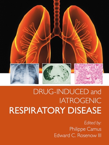 Паперова книга «Drug-induced and Iatrogenic Respiratory Disease», авторів Едвард Розенов III, Філіп Камю - фото №1