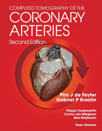 Бумажная книга «Computed Tomography of the Coronary Arteries» - фото №1