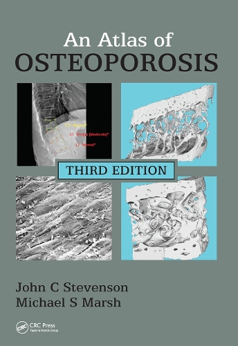 Паперова книга «An Atlas of Osteoporosis», авторів Джон К. Стівенсон, Майкл С. Марш - фото №1
