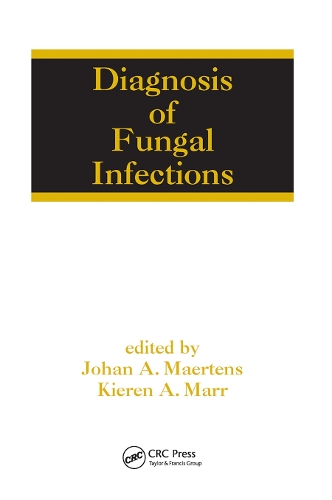 Паперова книга «Diagnosis of Fungal Infections» - фото №1