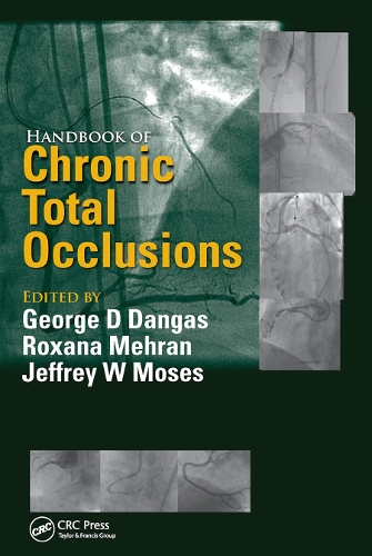 Бумажная книга «Handbook of Chronic Total Occlusions» - фото №1