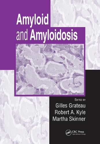 Паперова книга «Amyloid and Amyloidosis» - фото №1