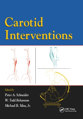 Паперова книга «Carotid Interventions» - фото №1