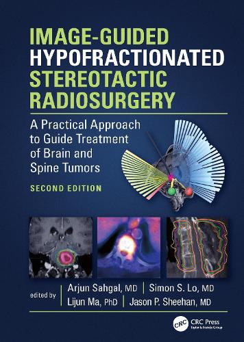 Паперова книга «Image-Guided Hypofractionated Stereotactic Radiosurgery: A Practical Approach to Guide Treatment of Brain and Spine Tumors» - фото №1