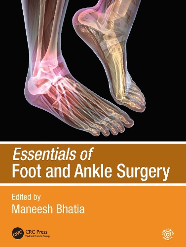 Паперова книга «Essentials of Foot and Ankle Surgery» - фото №1
