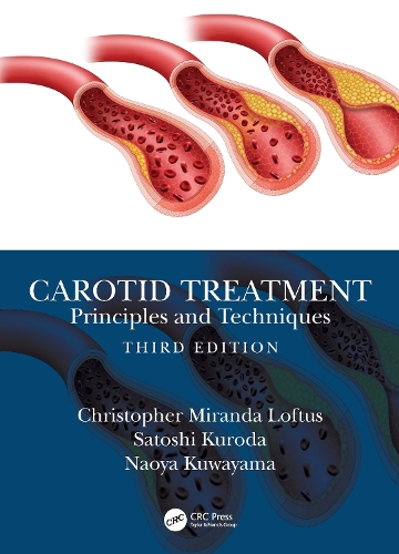 Паперова книга «Carotid Treatment: Principles and Techniques», авторів Крістофер Міранда Лофтус, Наоя Куваяма, Сатоші Курода - фото №1
