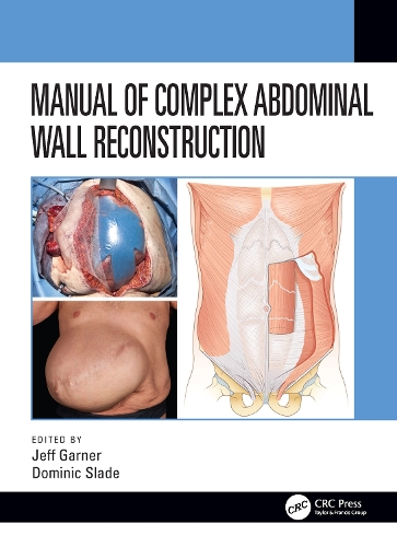 Бумажная книга «Manual of Complex Abdominal Wall Reconstruction» - фото №1