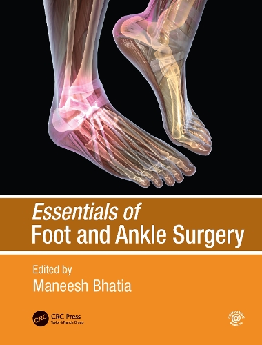 Бумажная книга «Essentials of Foot and Ankle Surgery» - фото №1