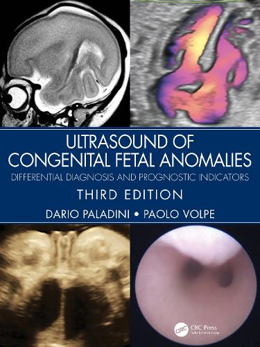 Бумажная книга «Ultrasound of Congenital Fetal Anomalies: Differential Diagnosis and Prognostic Indicators», авторов Дарио Паладини, Паоло Вольпе - фото №1