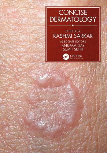 Паперова книга «Concise Dermatology» - фото №1