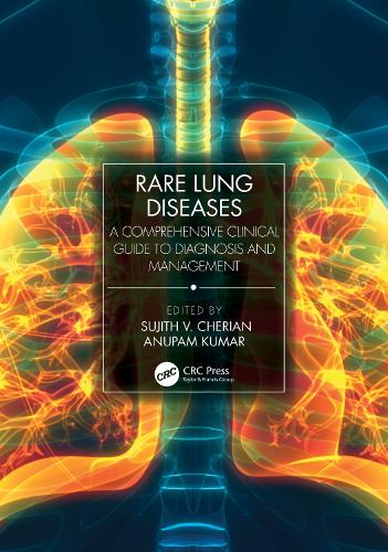 Паперова книга «Rare Lung Diseases: A Comprehensive Clinical Guide to Diagnosis and Management» - фото №1