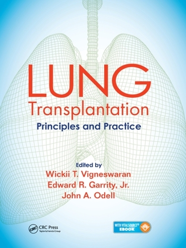 Паперова книга «Lung Transplantation: Principles and Practice» - фото №1