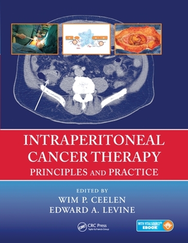 Бумажная книга «Intraperitoneal Cancer Therapy: Principles and Practice» - фото №1
