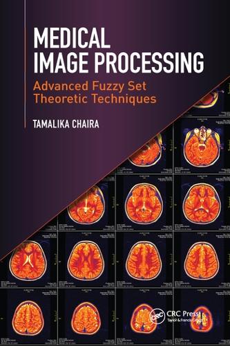 [object Object] «Medical Image Processing: Advanced Fuzzy Set Theoretic Techniques», автор Тамалика Чайра - фото №1